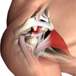 Distal Clavicle Excision