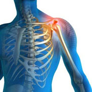 Shoulder Pain